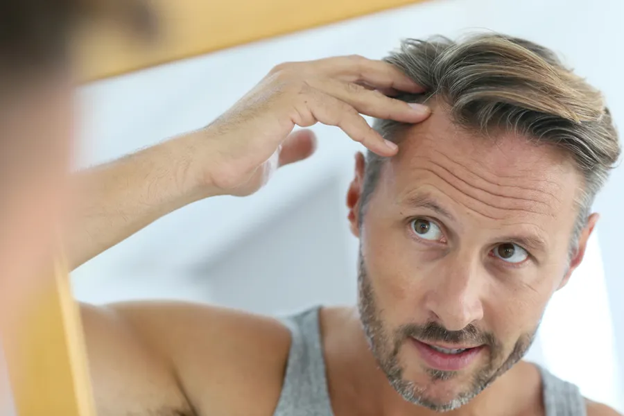 Hair-Restoration-Clinic A middle-aged man looks in the mirror, worried about his hairline. Schedule hair restoration treatments from Nonkulie Dladla, M.D. in Manhattan.