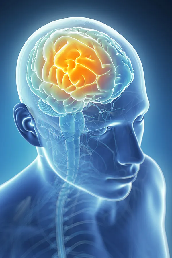 Migraine-Treatment 3D illustration of the brain with glowing pain center. Nonkulie Dladla, M.D. treats migraines using functional medicine in Manhattan.