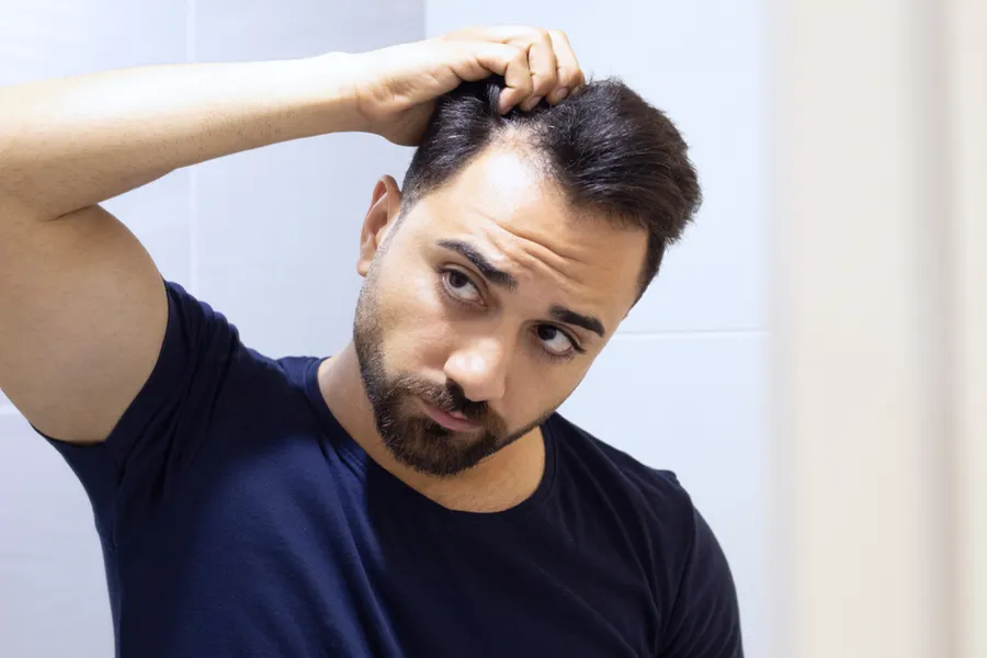 PRP-for-Hair-Loss-Doctor A man in a navy t-shirt looks in the mirror worrying about and touching his receding hairline, considering PRP for hair loss and restoration treatment from Nonkulie Dladla, M.D. in Manhattan.