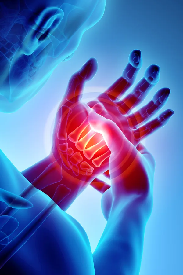 Stem-Cells-for-joint-Pain-Treatment 3D illustration of a man's x-ray holding his hand in pain. Get stem cells for joint pain from Nonkulie Dladla, M.D. in Manhattan.